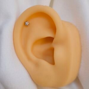 Arete de estrella