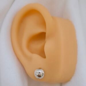 Arete de bola